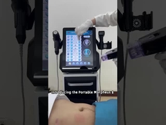 چطور از دستگاه میکروبرنج فرکانس رادیویی استفاده کنیم؟