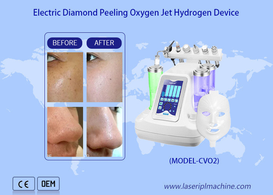 پاکسازی عمیق صورت آب اکسیژن جت پیلینگ ماشین / هیدرو Dermabrasion آب اکسیژن جت پاکسازی عمیق پوست