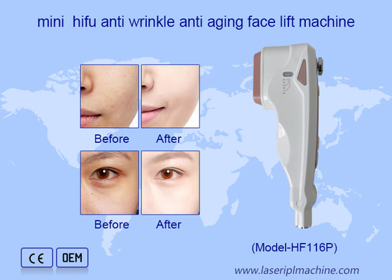 استفاده خانگی HIFU مراقبت از صورت پاکسازی چین و چروک جوان کردن پوست ماشین رفع صورت