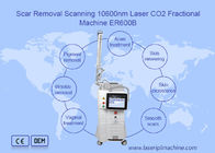 دستگاه لیزر CO2 فرکشنال 10600 نانومتری برای بازسازی پوست