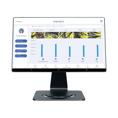 دستگاه هدفمند مراقبت از پوست سر هوشمند با هوش مصنوعی و 4 زبان برای آنالیز پوست سر و مو